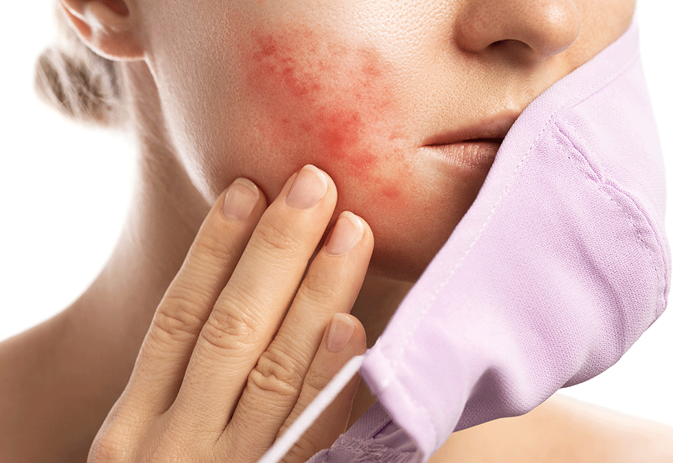 Protecting Your Skin While Wearing a Face Mask